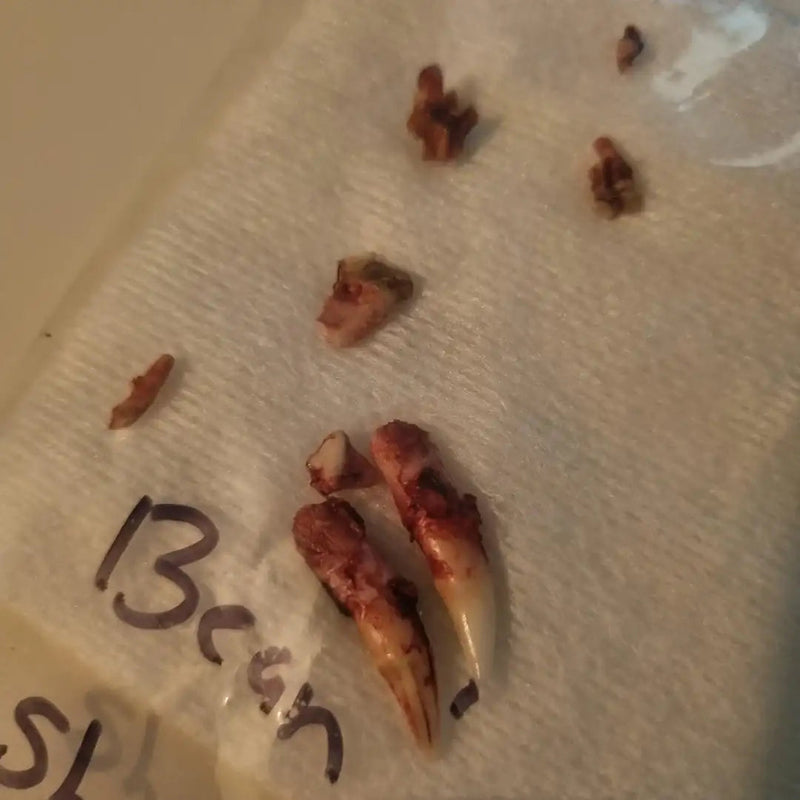 Teeth Pulled — Gone Forever